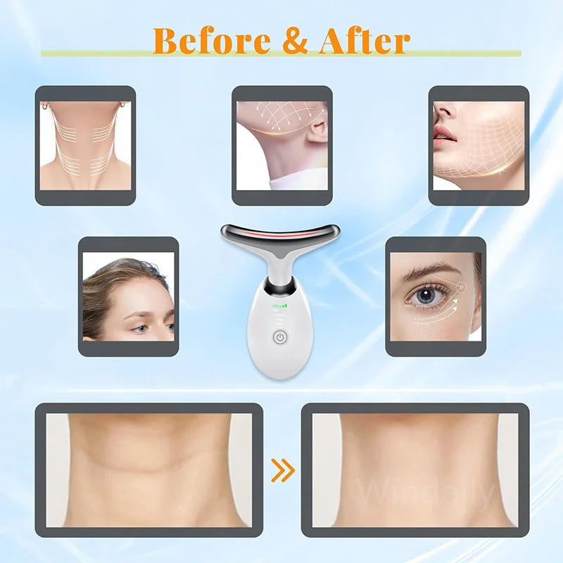 Face & Neck Lifting – Firms jawline, reduces sagging skin.