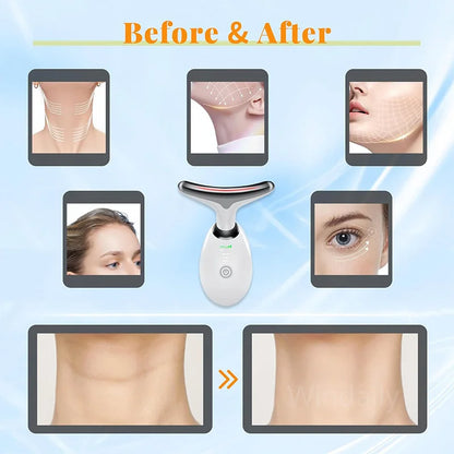Face & Neck Lifting – Firms jawline, reduces sagging skin.